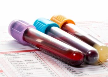 Ці продукти згущують кров, тож з ними слід бути обережними