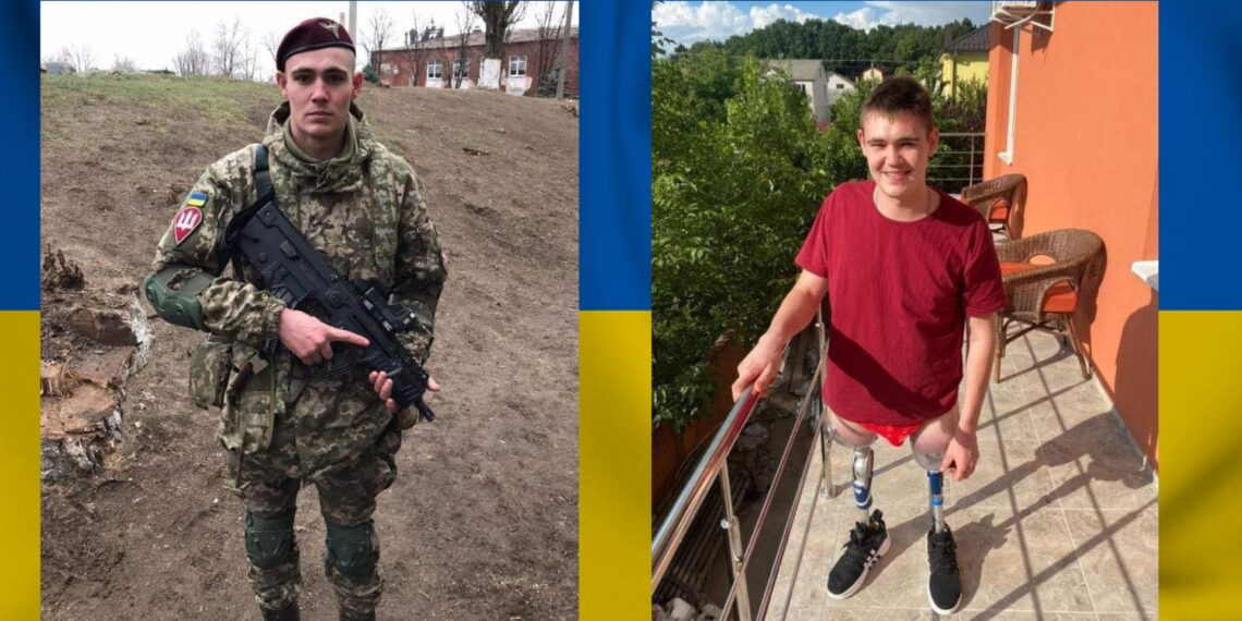 Попереду в Миколи багато справ. Він не збирається падати духом. Фото з домашнього архіву.