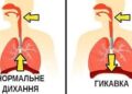 Гикавка – це мимовільне, синхронне скорочення міжреберних м’язів та діафрагми, яке викликає різкий вдих, з подальшим закриттям голосової щілини з характерним звуком «гик». Фото: encrypted-tbn0.gstatic.com