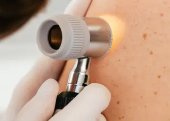 Небезпека полягає в тому, що деякі форми раку шкіри можуть маскуватися під звичайну папілому. Фото: esteva.com.ua