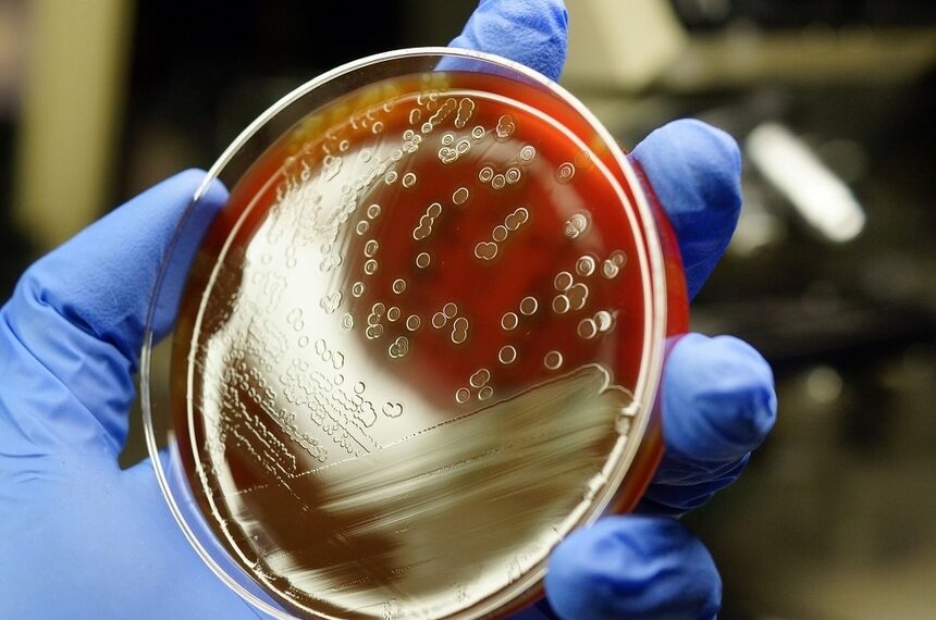 Щорічно у світі фіксують 30 мільйонів випадків сепсису, а близько 6 мільйонів людей помирають через цю недугу. Фото: botkin.pro