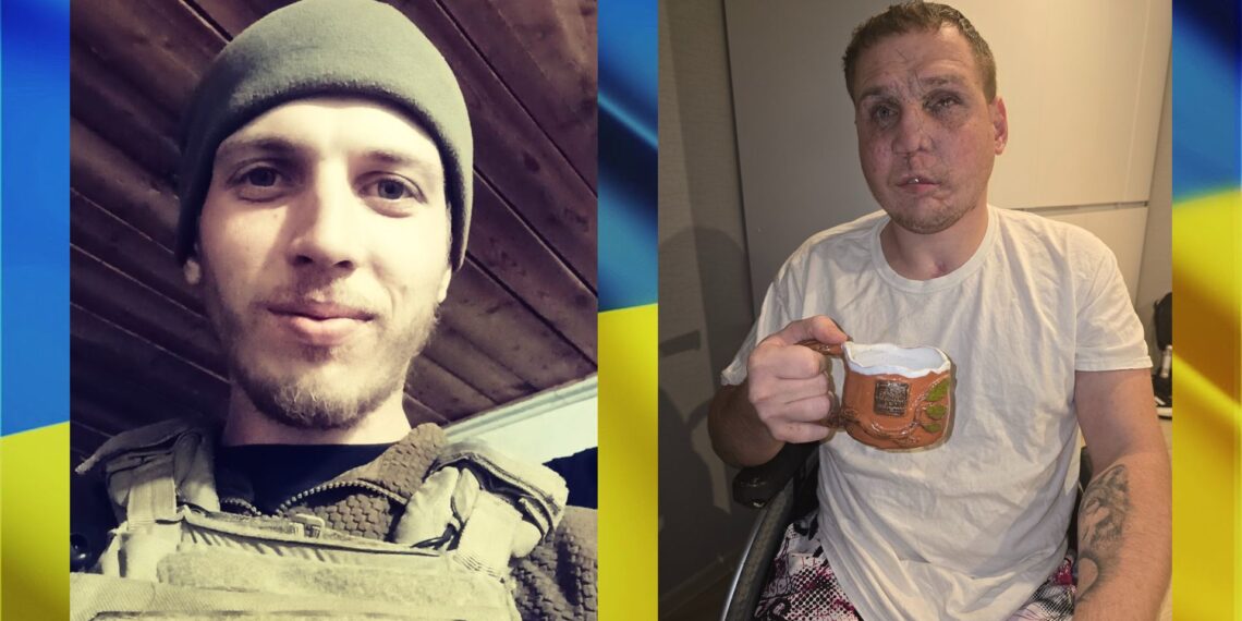 На фото: випробування, які випали на долю 28-річного Сергія Райляна, під силу здолати лише міцним духом людям. Фото надане Сергієм Райляном.